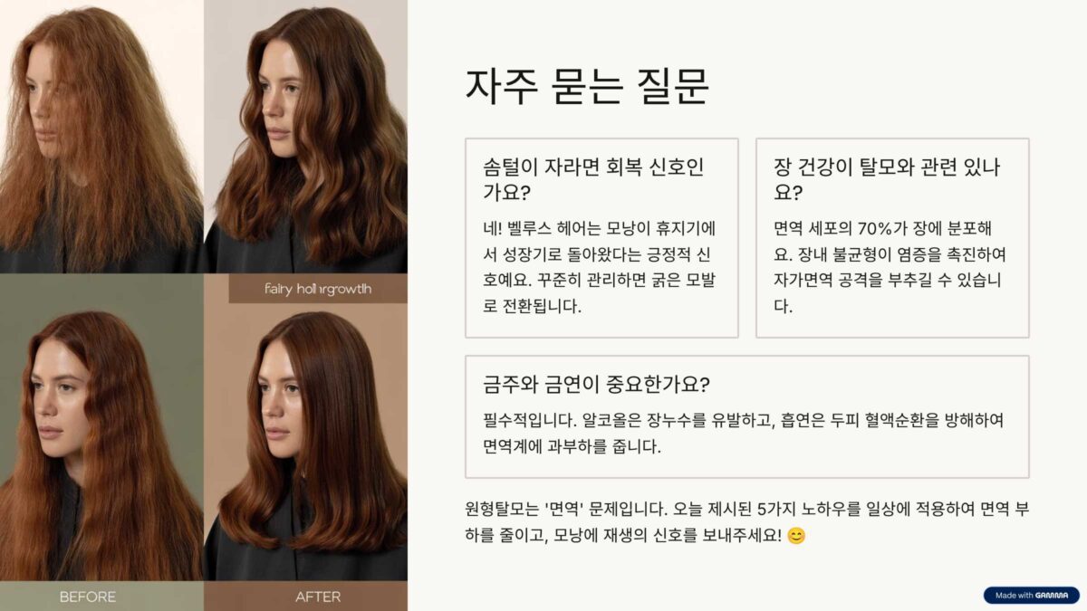 원형탈모 자주묻는질문